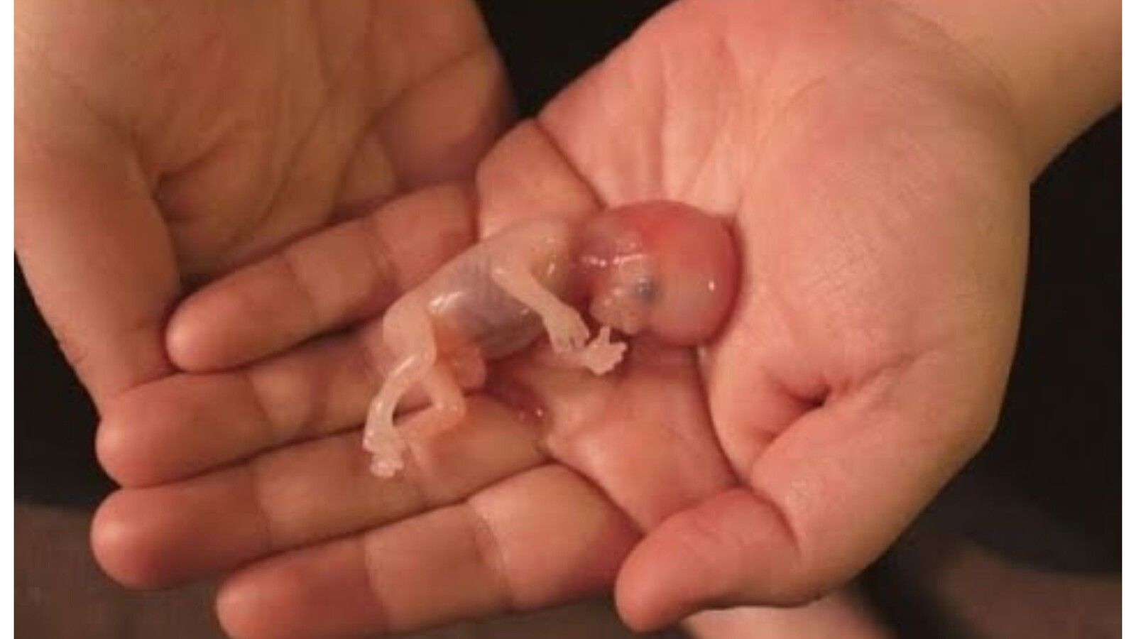 aborto